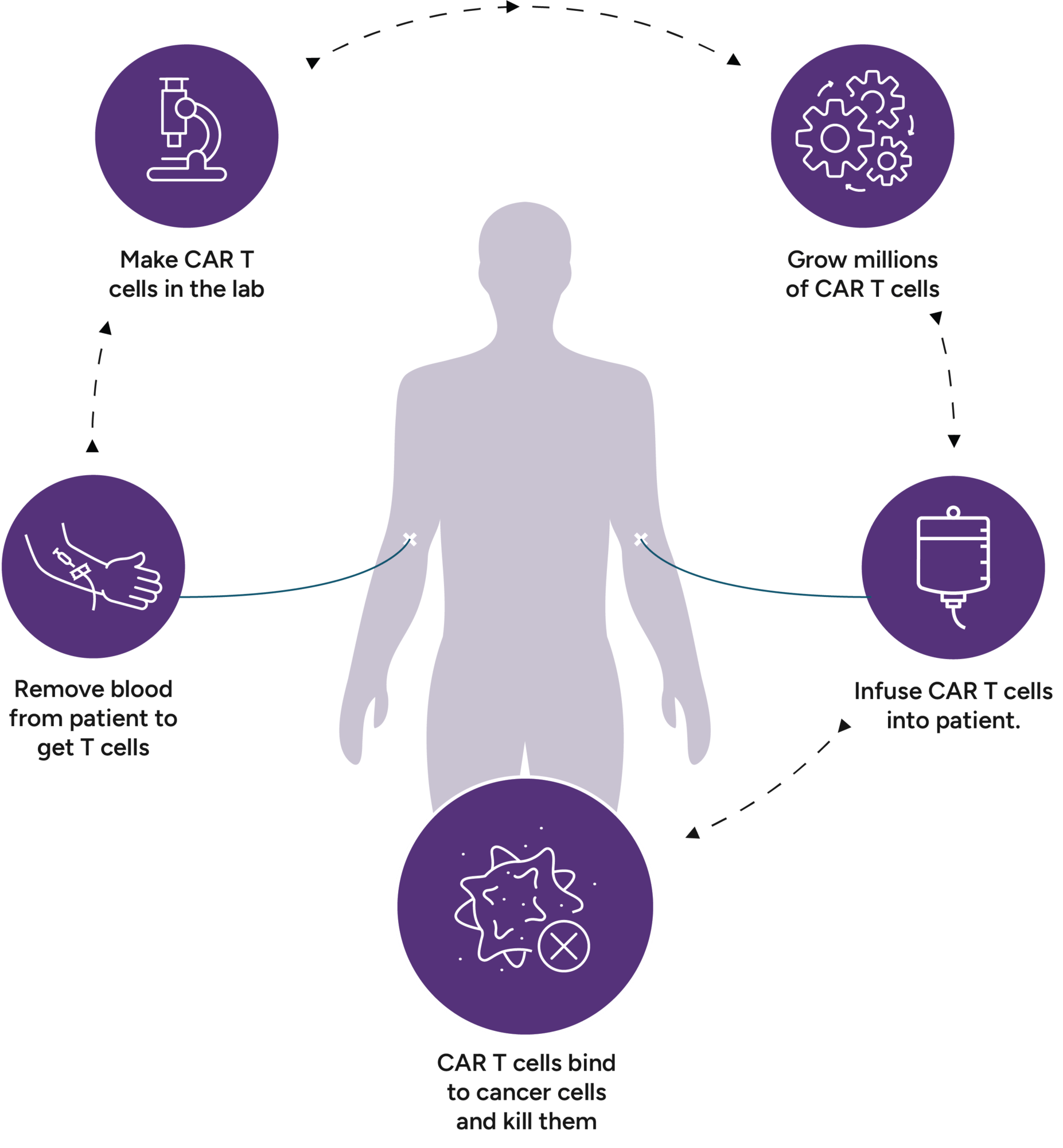 Bmc Is Now Offering Car T Cell Therapy Boston Medical Center