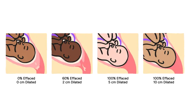 BMC_01.29_16:9 - Grid-CervicalCh